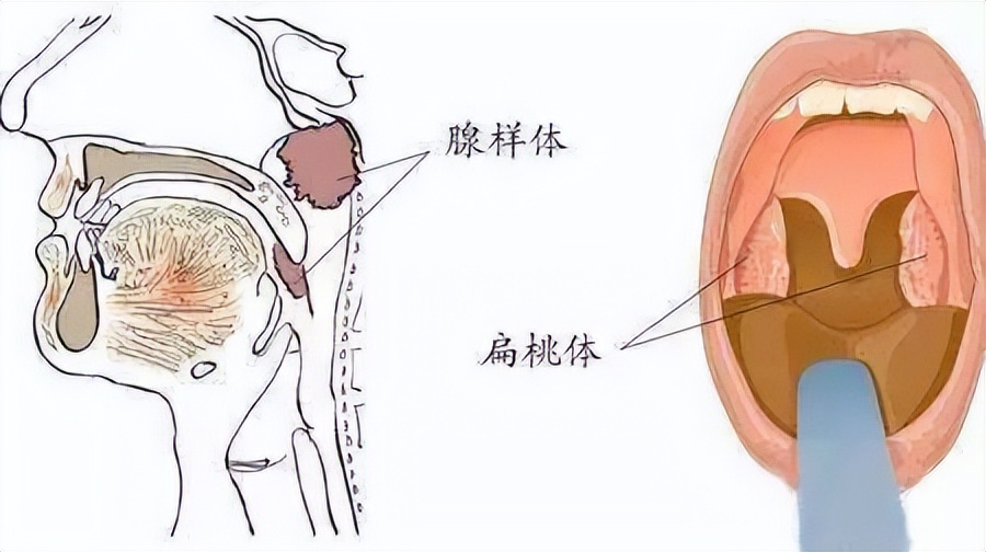 7岁小孩感冒后睡觉一直打鼾,男孩感冒后睡觉打呼噜怎么回事