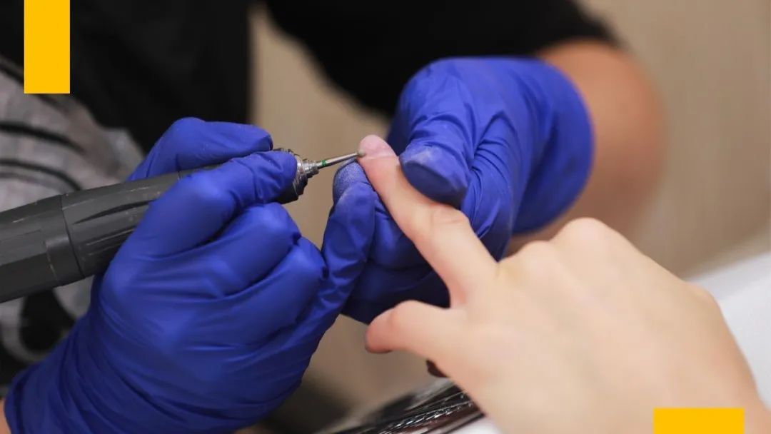 光疗延长甲为什么不建议做,光疗最常见的不良反应