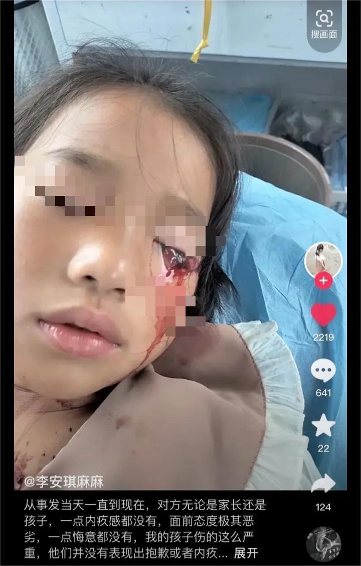 江苏13岁男孩打瞎女孩,13岁男孩打瞎女孩后续