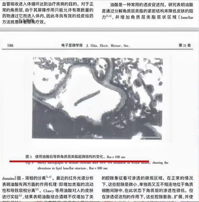 宝宝面霜黑脸成分大揭秘，宝宝皮肤变黑原来是这样，宝妈快自查