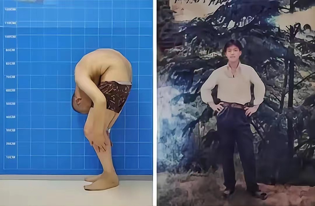 鎶樺彔浜烘潕鍗庤鏁叉柇鍚庨噸濉戠殑浜虹敓,鎵撳叆22鏍归挗閽夌殑鏉庡崕濡備粖鎬庢牱