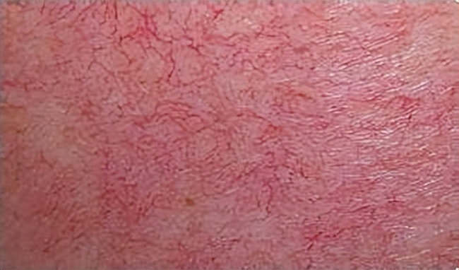 人体温度40度高温能待多久,40度高温人体什么感觉