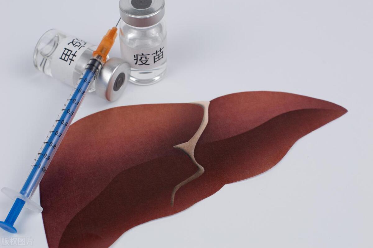 有了肝囊肿怎么办？很严重吗？需要治疗吗？