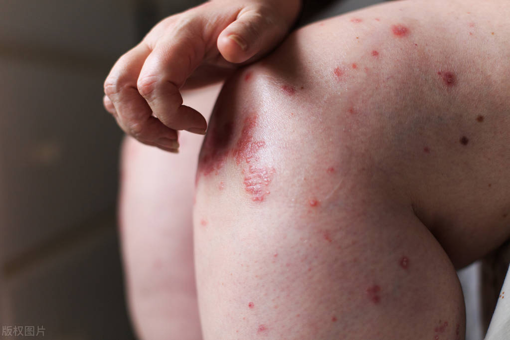 小便之后该用纸擦吗,小便过后用手纸擦可以吗