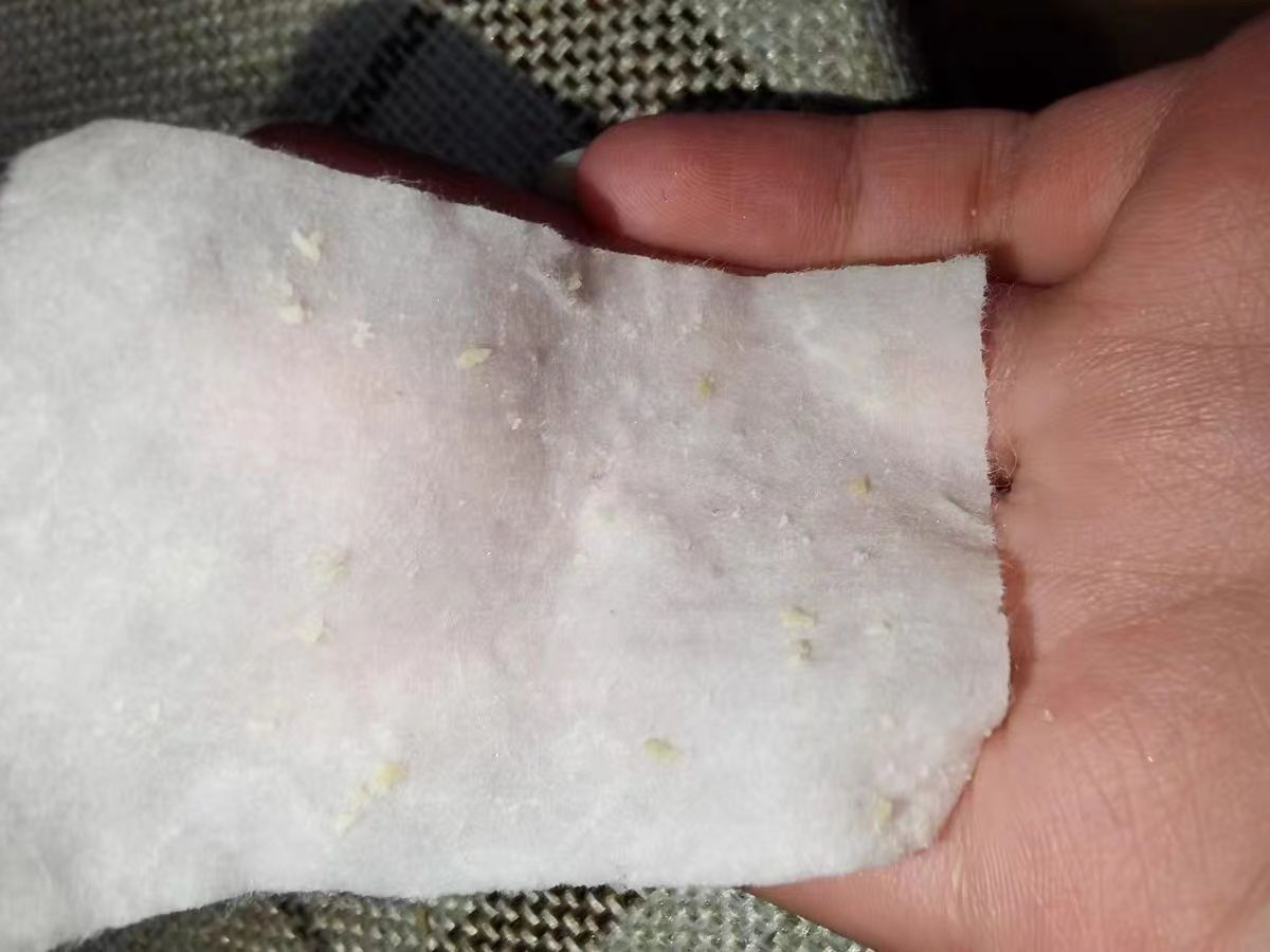 美容院护肤去黑头正常价格,小气泡去黑头美容仪器