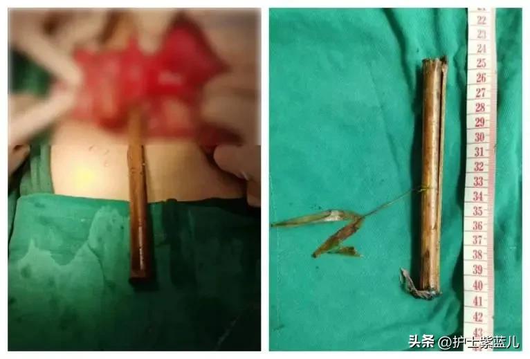 老人从高处跌落昏迷,老人不慎从台阶摔下躺在地上