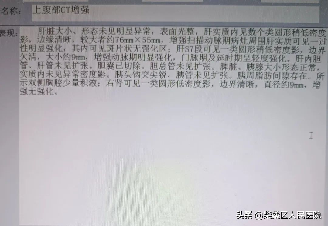 肝脓肿中西医结合治疗,肝脓肿淄博哪家治疗最好