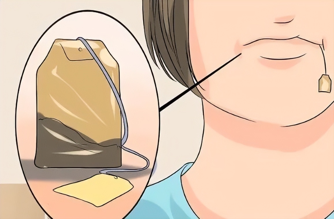 拔牙后伤口好了牙龈肿痛,拔牙后牙龈如何快速消肿