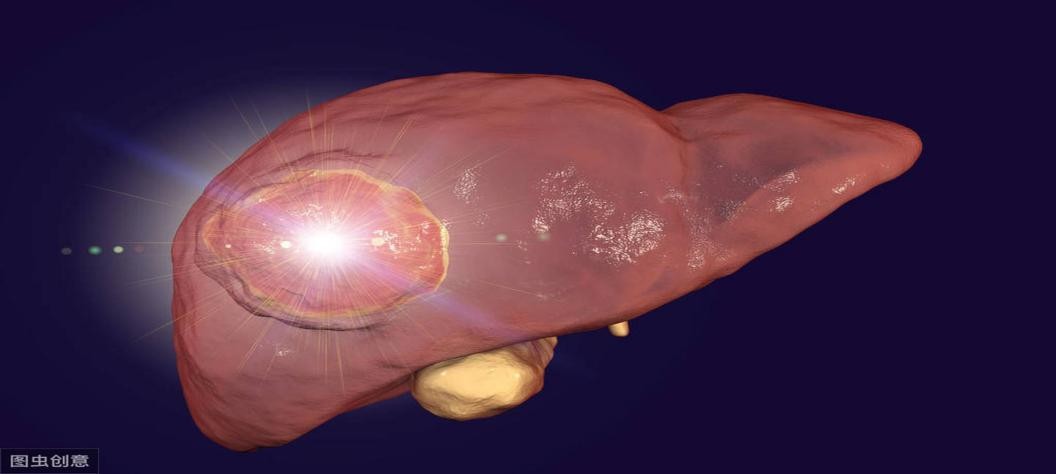 儿童肝血管瘤什么原因引起,乳腺癌患者肝血管瘤原因