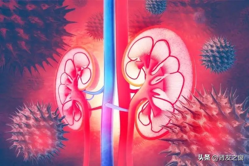 什么是肾盂肾炎?它的“元凶”是谁?