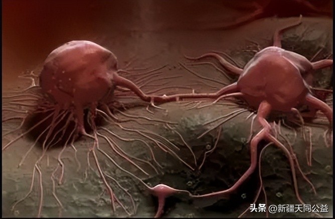 我国现存艾滋感染超105万，50岁以上占44%，为啥艾滋盯上老年人