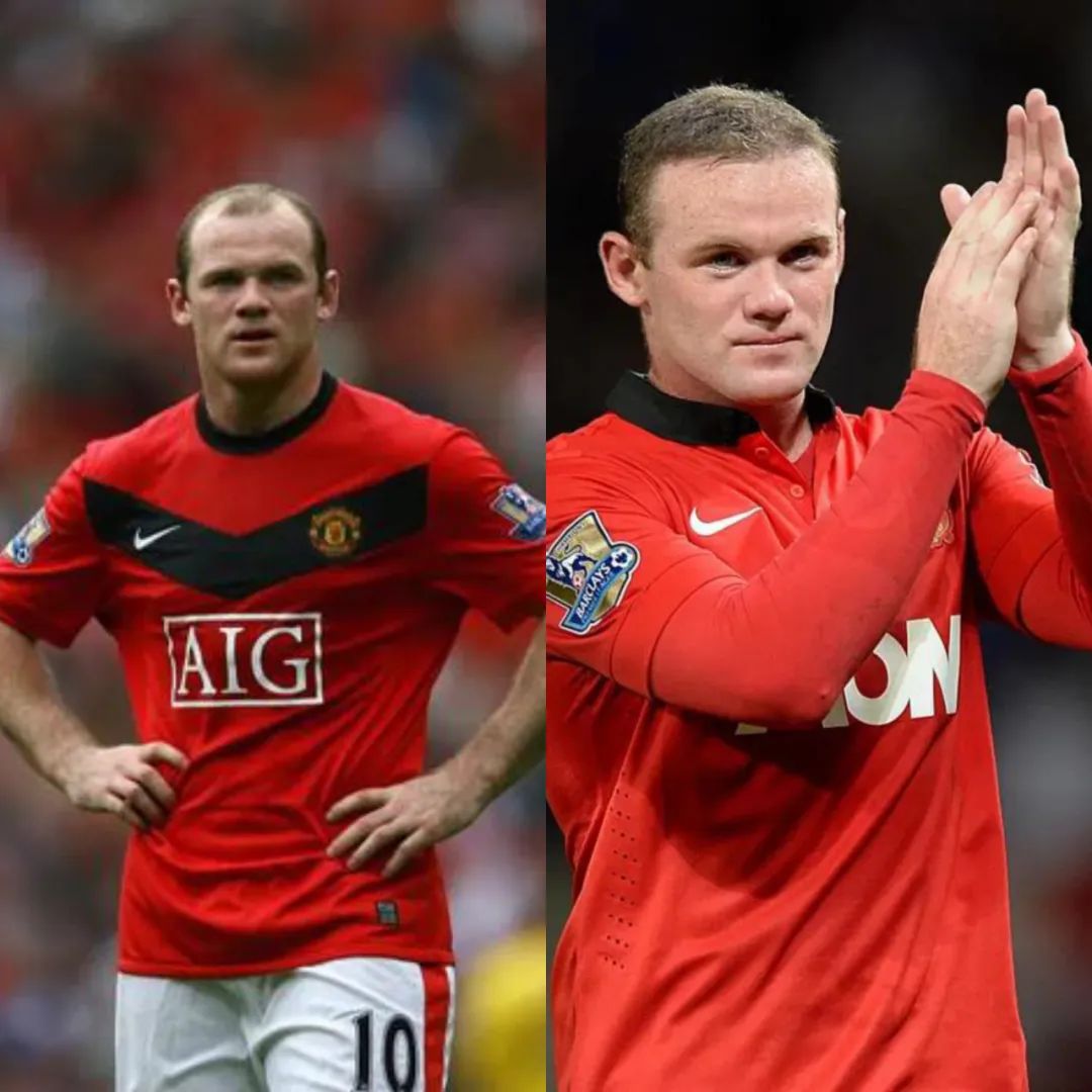 植发行业跟整形医美行业哪个更好,世界杯球星美容