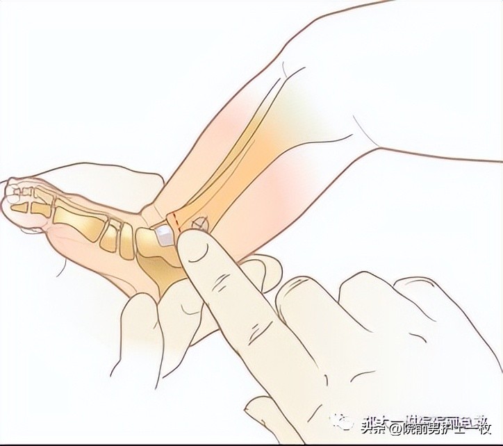 骨髓腔穿刺急救,骨髓腔穿刺适应症和禁忌症