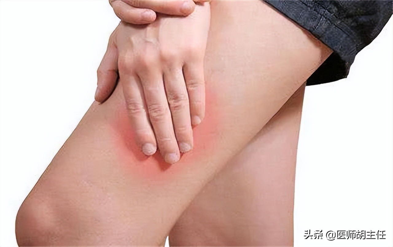 30岁腿痛查出宫颈癌案例,宫颈癌晚期腿上4个信号提示