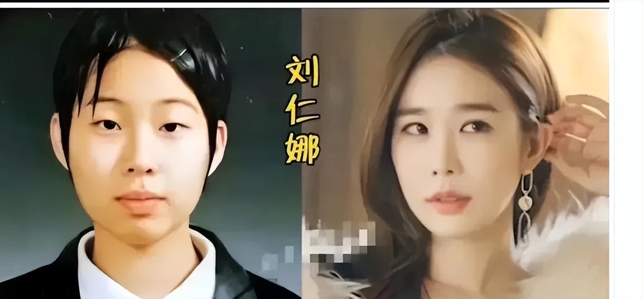 中国明星韩国整容对比,韩国明星整容变毁容