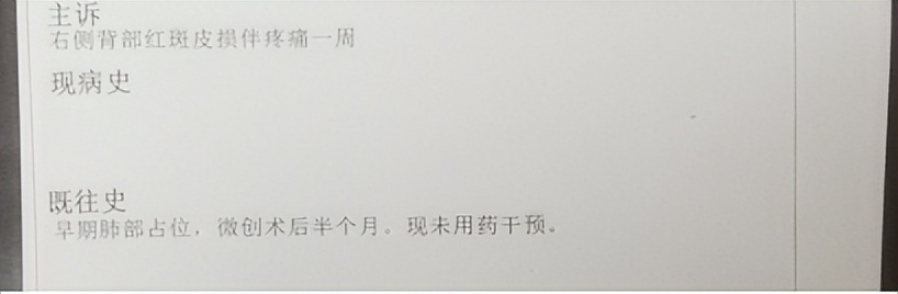 女子背部“盘蛇”，疼得受不了！医生：中西医抗病毒，疗效更强