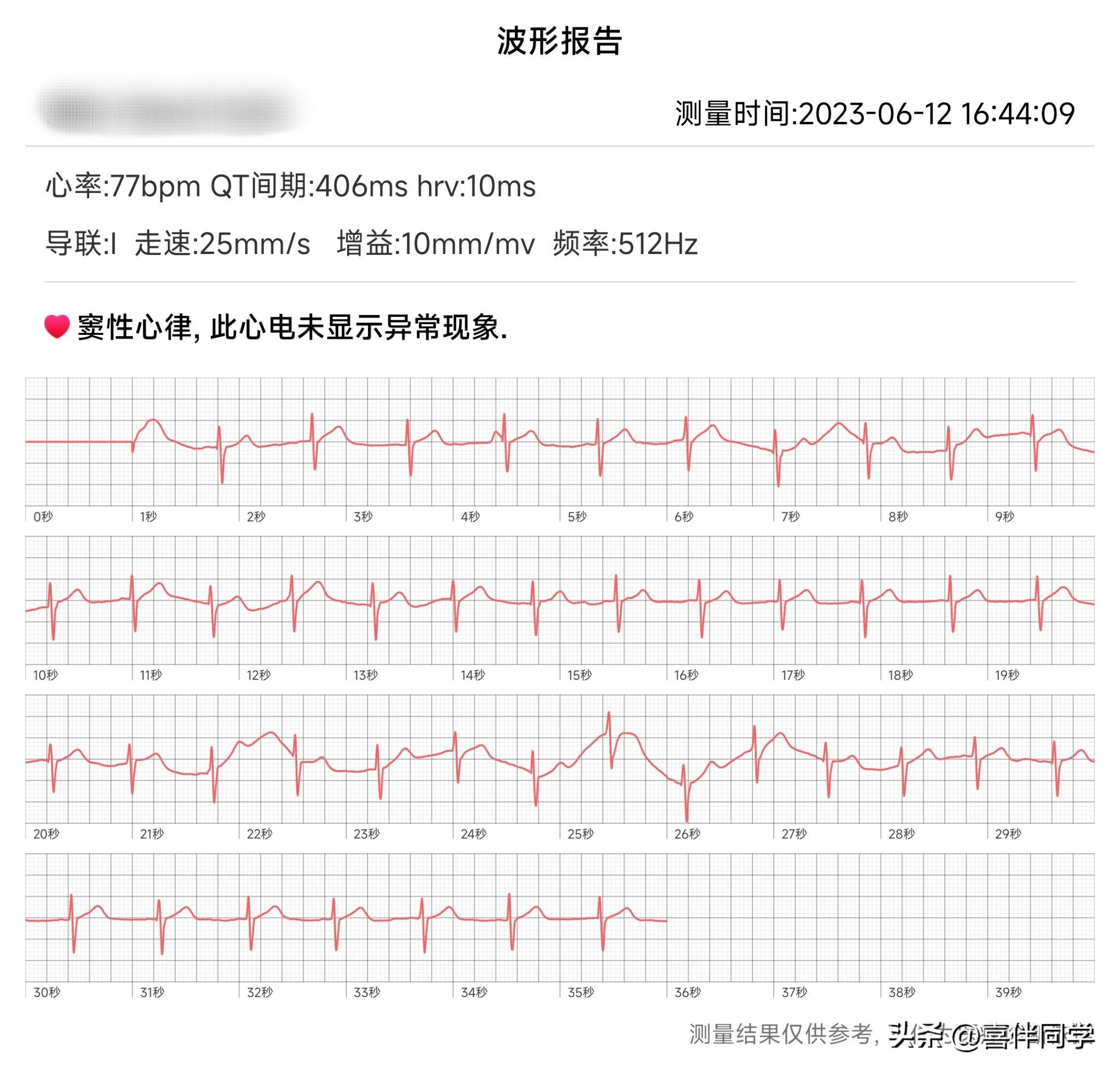 智能测血压心率手环,测血压心电图心率手环推荐