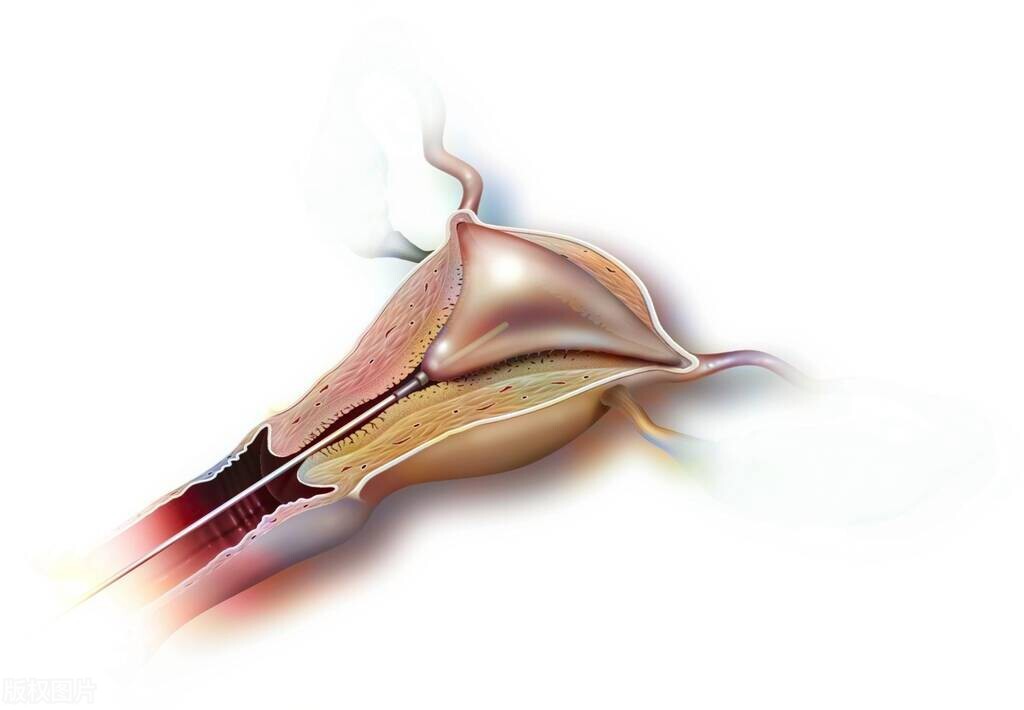 三胎开了5指,三胎开5指多久能生