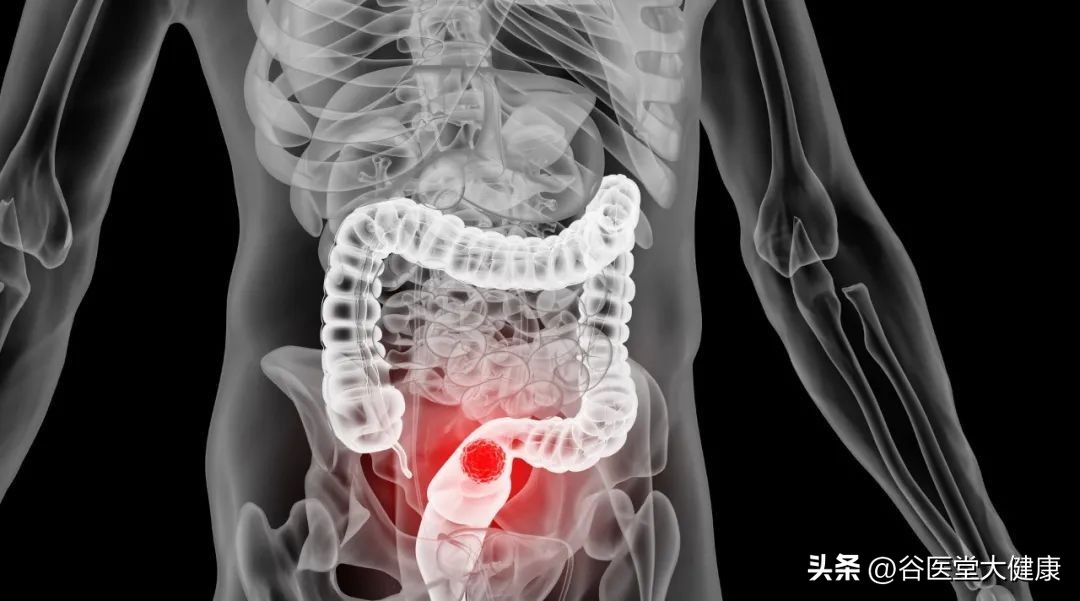 谷方益元治便秘,谷经堂治疗便秘手法