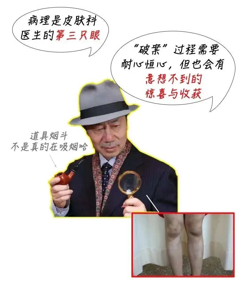 11岁男童额头上长满小疙瘩,10岁男孩子额头长斑