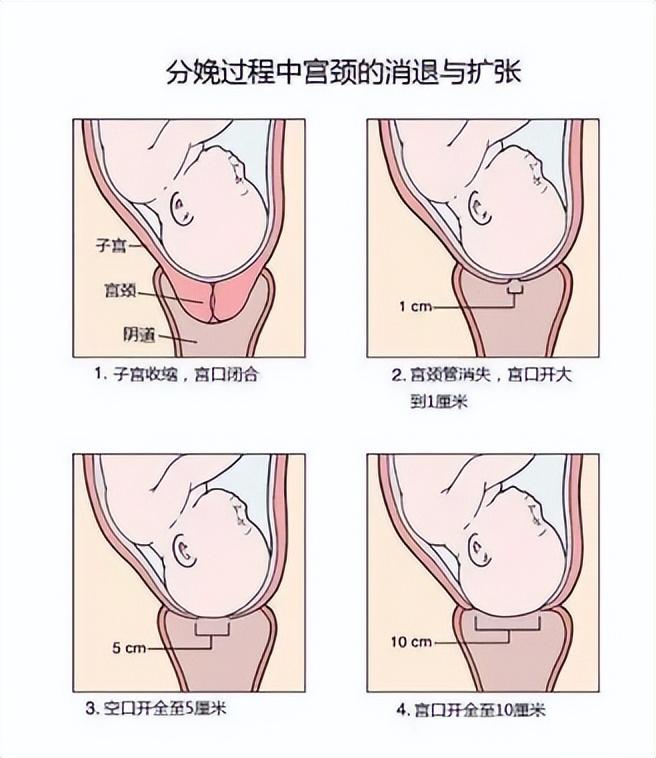 产后芒果网状裂伤,顺产撕裂伤像网状芒果吗