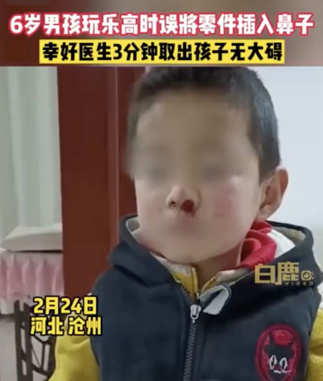 真狠！6岁熊孩子玩乐高时误将零件插入鼻中，导致鼻腔鲜血直流