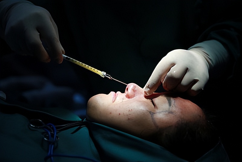 假体隆胸假体被调包后怎么维权,假体鼻子被人打歪怎么赔付