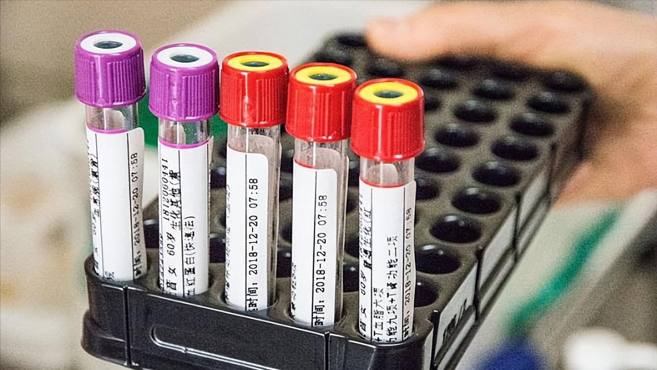现在看病为什么动不动就要验血,医院里验血抽的血最后都去哪里了