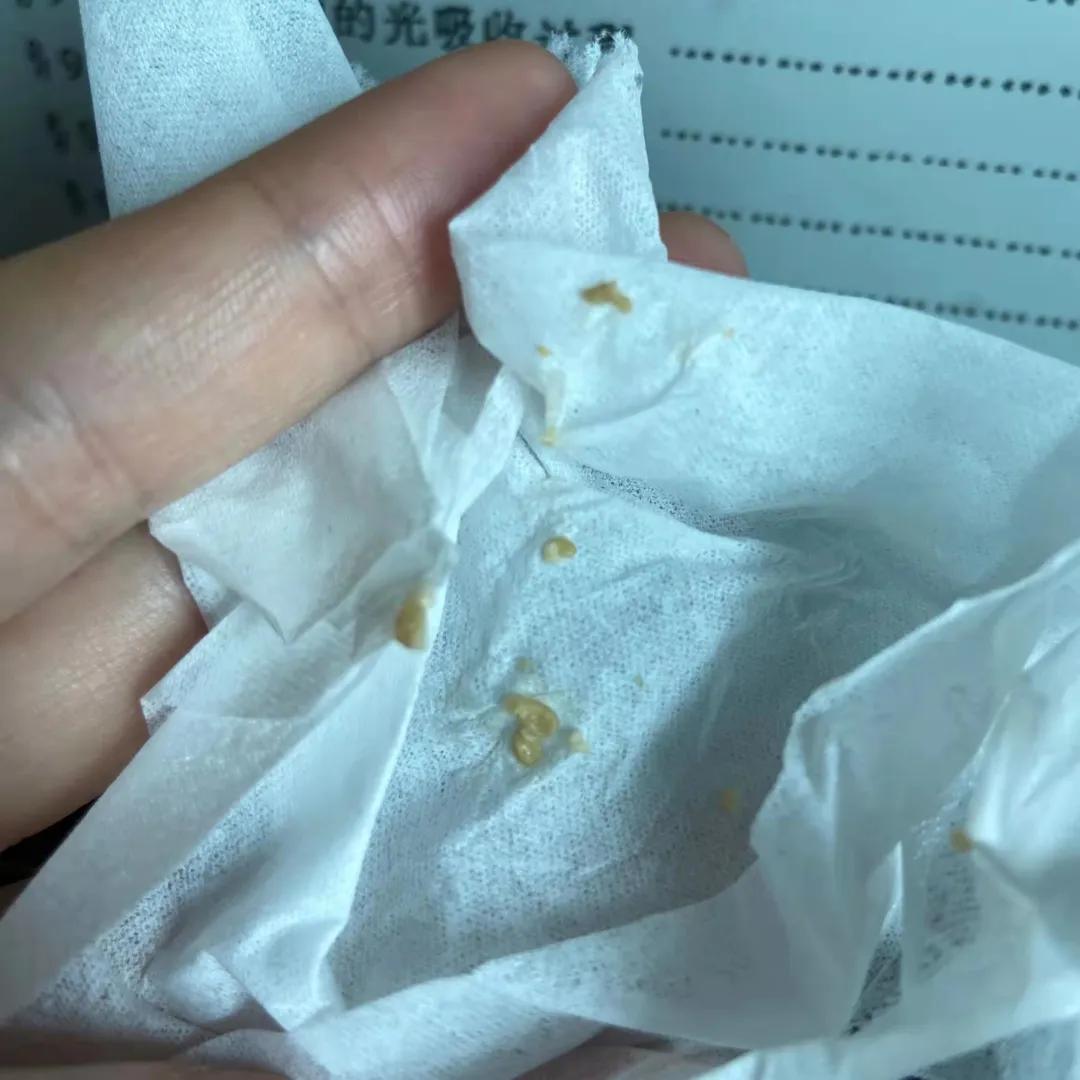 吐出黄色的苦东西咋回事,吐出了黄色绿色的苦水是什么