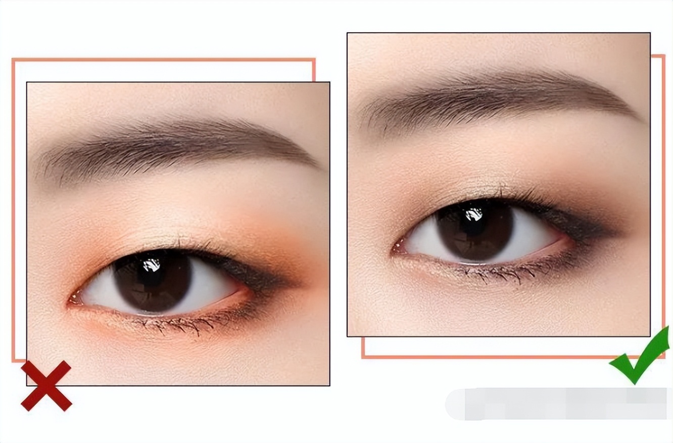 单眼皮肿眼泡早晨消肿,天生单眼皮肿眼泡消肿神器