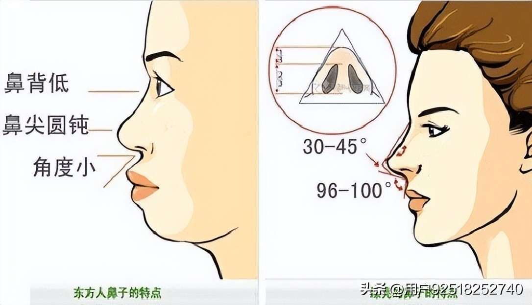 法令纹鼻基底深怎么改善,怎么判断法令纹是鼻基底凹陷