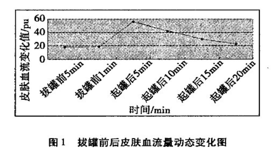 拔火罐吸出来的是湿气还是毒素,拔火罐出来的瘀血是什么样