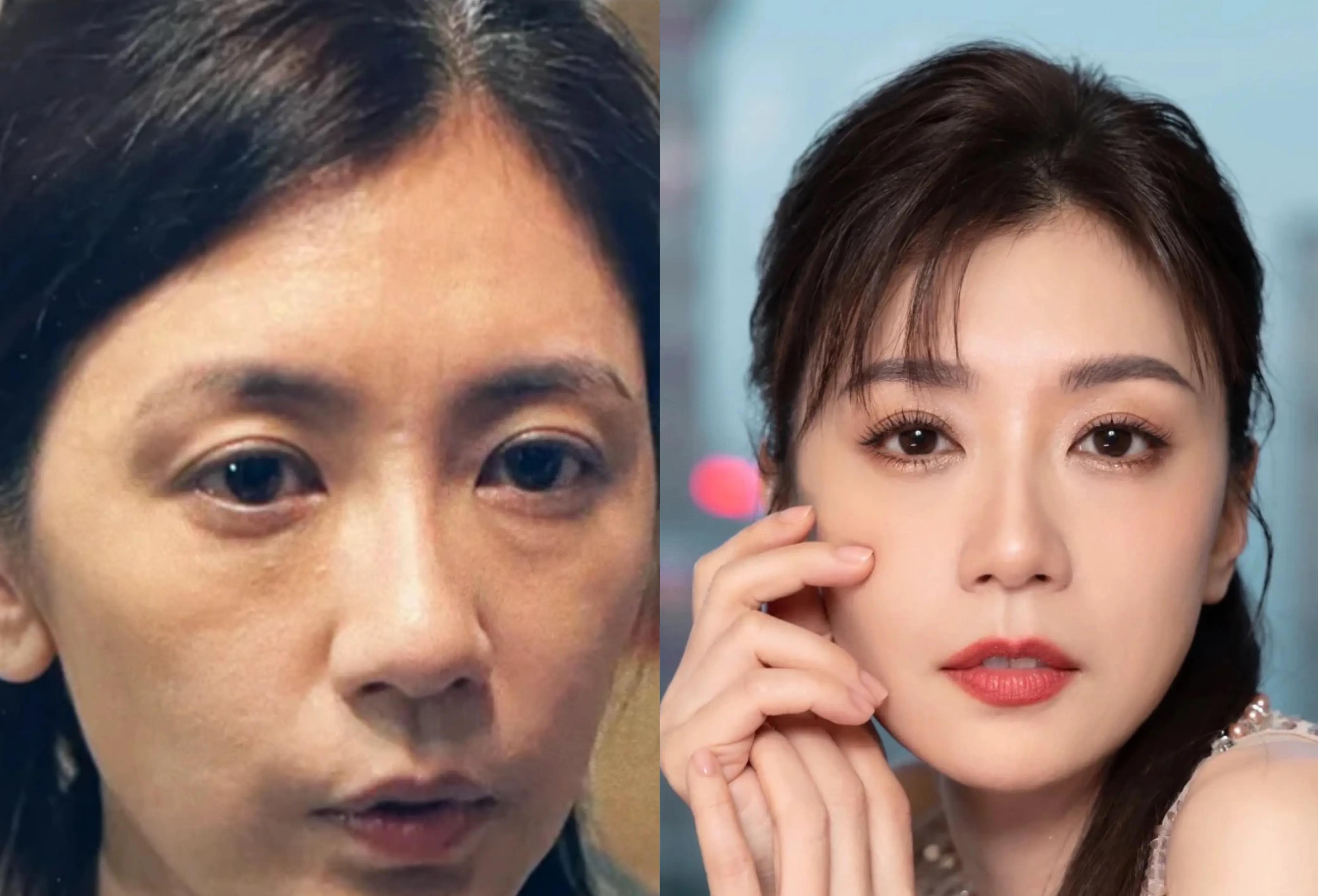 女明星集体回春做了什么医美,女明星集体回春