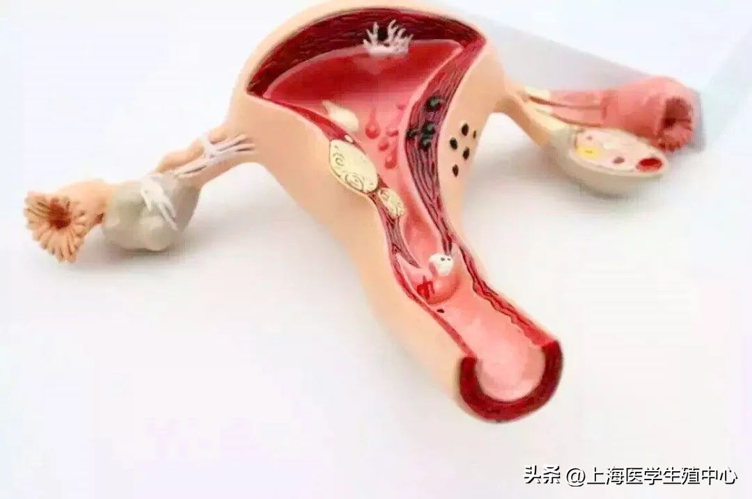 试管移植几次不着床是没希望了吗,试管移植总是不着床都是什么原因