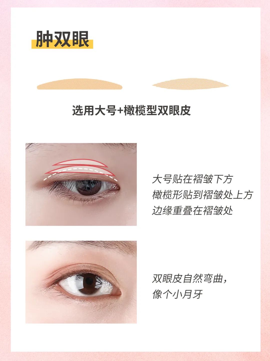 不同眼型的双眼皮贴贴法,各种眼型的双眼皮贴法详细教程