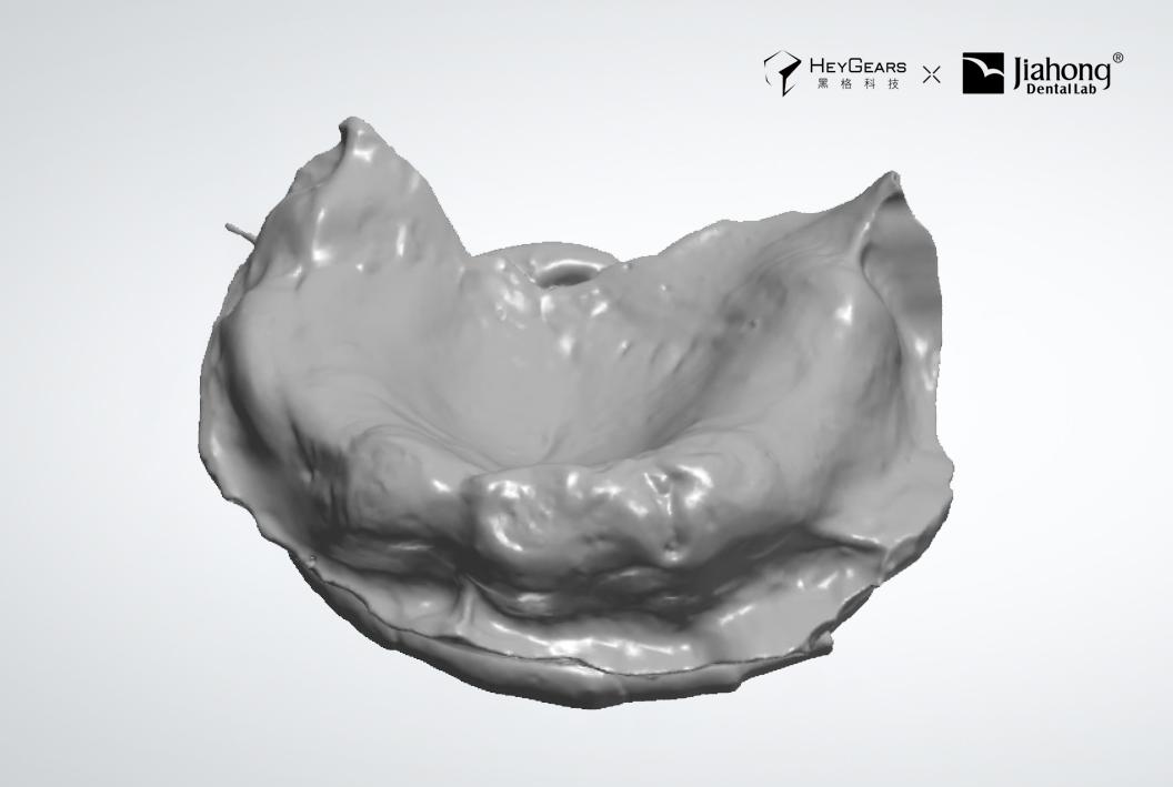 干货分享口腔,全口义齿是怎样做的