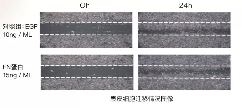 四效合一瘦身方案,四效合一全新升级