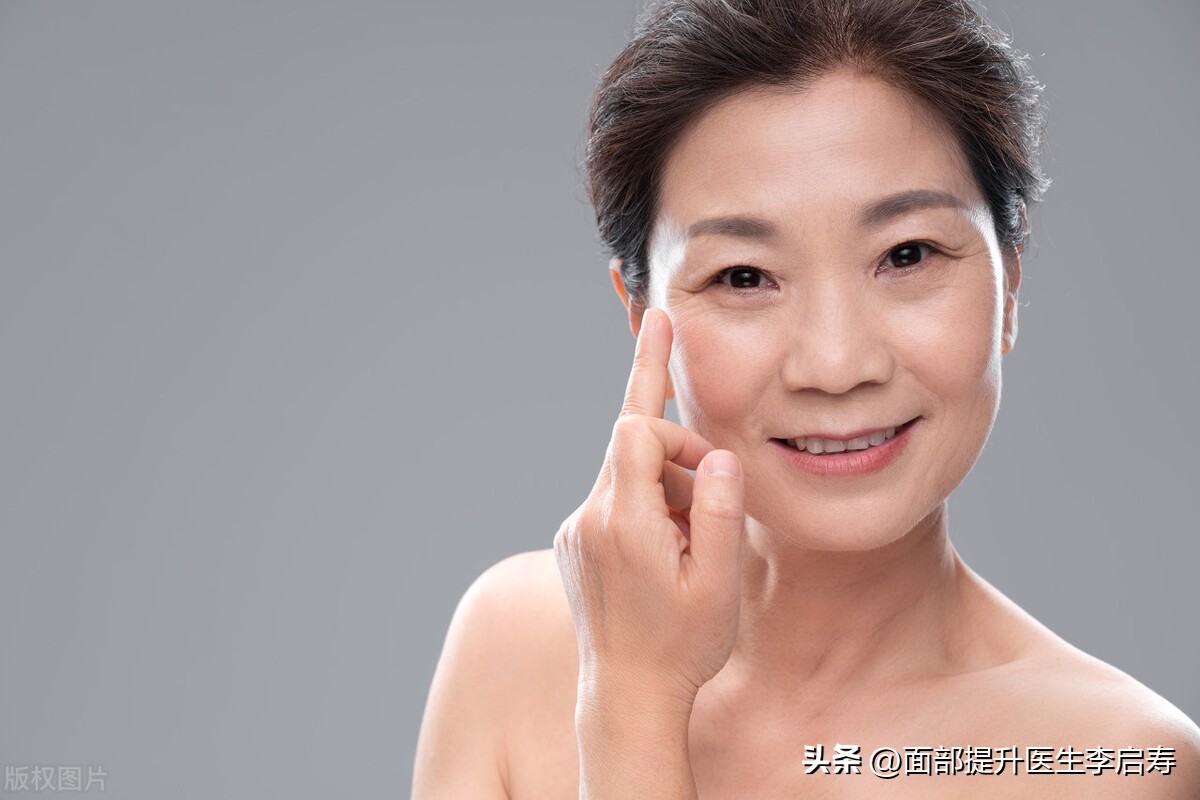 面部筋膜提升多久才是最佳效果,面部筋膜提升术5年后加速衰老