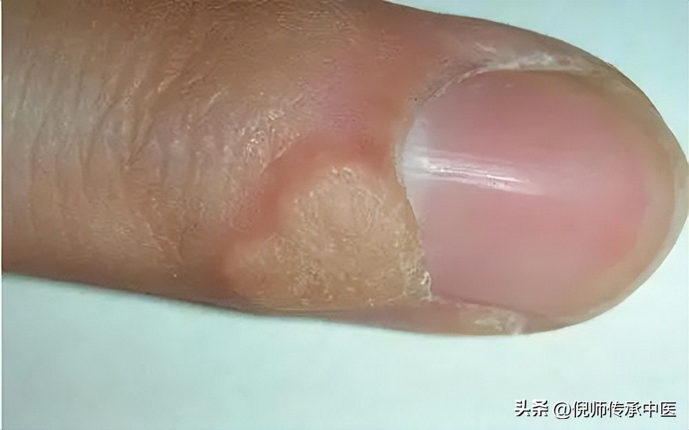 倪海厦讲黄帝内经阳气,倪海厦讲阳气很足是怎么样的