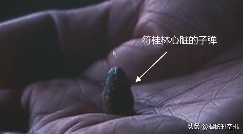 中国孤例！*弹子**击中心脏14年没死？湖南男子奇迹生还至今成谜