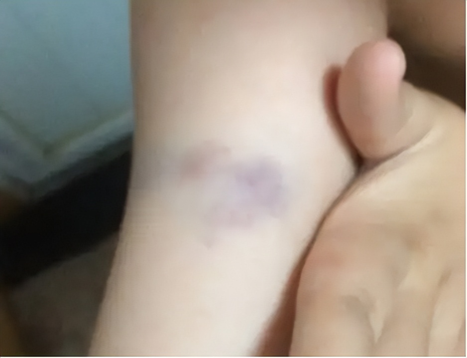 筋膜枪使用方法及注意事项,筋膜枪其他小妙招