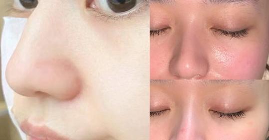 孕期用什么样的水乳比较好,孕期选水乳的注意事项