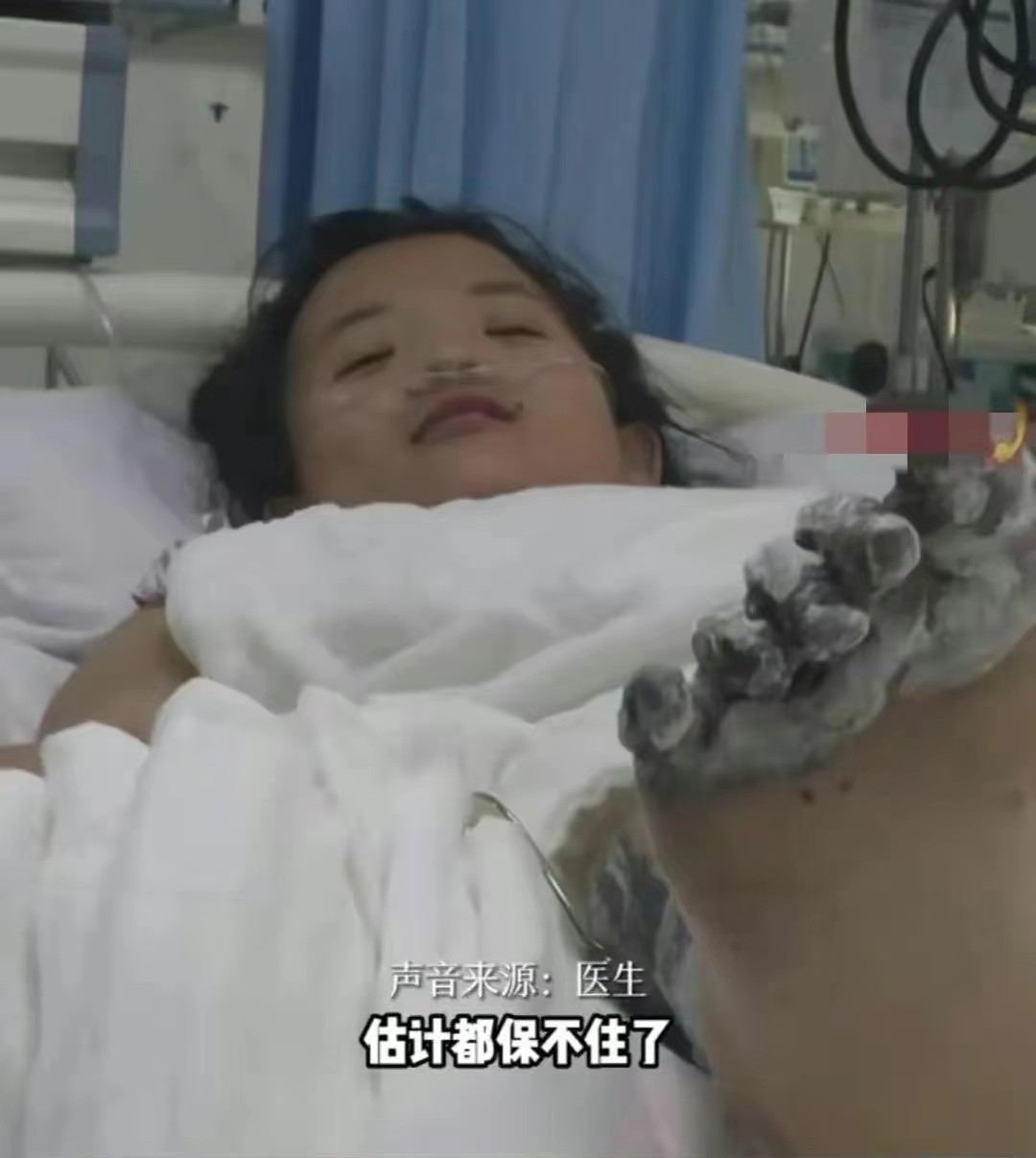 被电击女孩因脏器受损面临截肢,女孩充电时玩手机被电击面临截肢