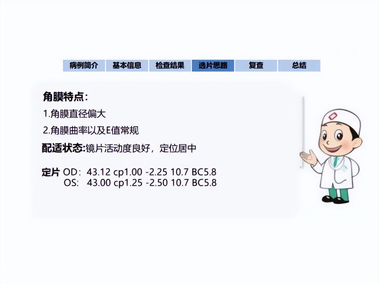 王凯角膜塑形镜原理,王凯医生塑形镜