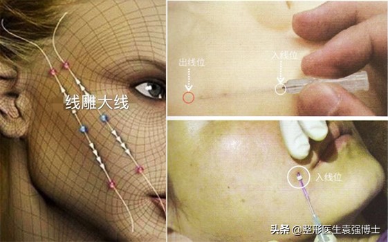 40岁以后要选择什么样的医美项目,40岁医美行业能干什么