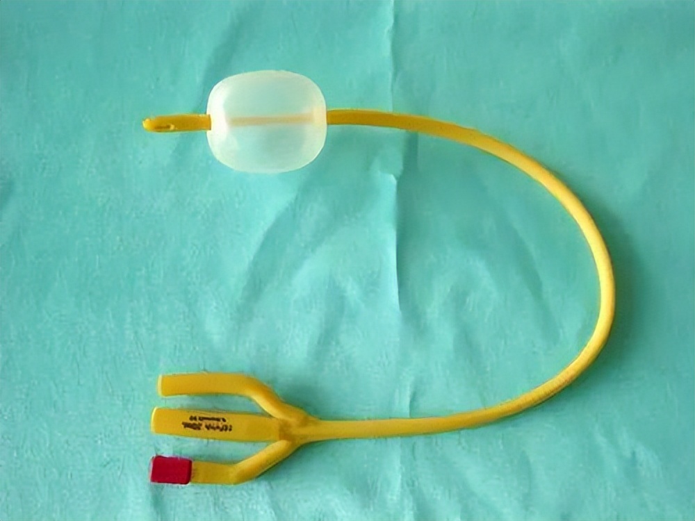 手术插尿管导致后遗症,做完手术插尿管有什么坏处吗