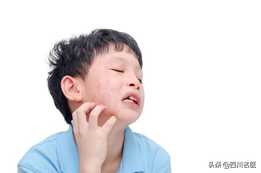 春季面部皮肤发红发痒怎么办,春天面部痒怎么回事