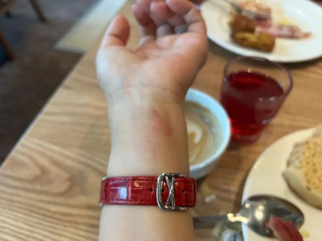 被固执的老公在伦敦街头气到炸,却因为一只马蜂和好了?