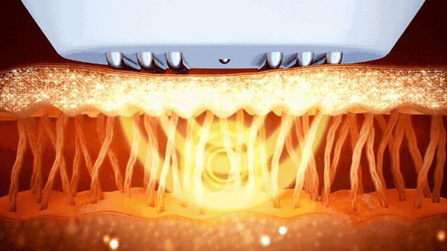 眼部护理的小秘密,眼部护肤应该涂哪些护肤品