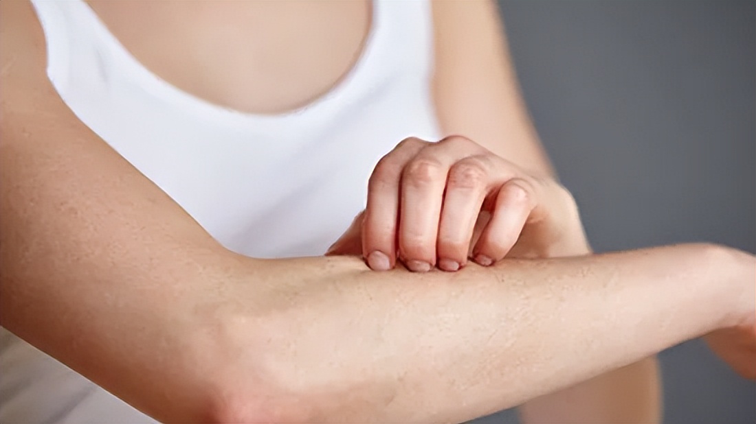 被蚊虫咬了一直反复痒如何处理,为什么被蚊虫咬了会红肿起泡